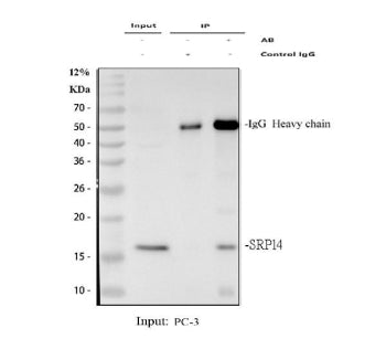 Immunoprecipitation of SRP14 protein from 500ug of human PC-3 whole cell lysate with 2ug of SRP14 an