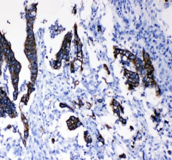 Cytokeratin 8 Antibody