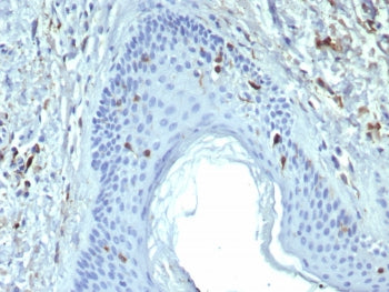 IHC staining of FFPE human skin tissue with Langerin antibody (clone LGRN/7428). HIER: boil tissue s