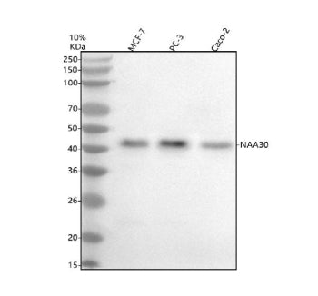 Western blot analysis of NAT12/NAA30 using anti-NAA30 antibody. Electrophoresis was performed on a 1