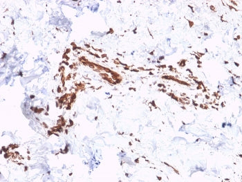 IHC staining of FFPE human skin with Collagen VII antibody (clone LH7.2). HIER: boil tissue sections