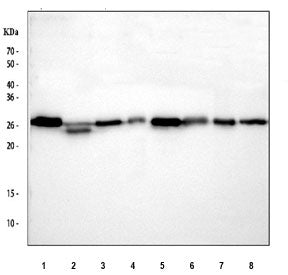 Western blot testing of 1) rat brain, 2) rat kidney, 3) rat RH35, 4) rat PC-12, 5) mouse brain, 6) m