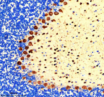 IHC staining of FFPE rat cerebellum tissue with PVALB antibody, HRP-secondary and DAB substrate. HIE