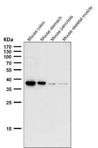 All lanes use the CXCR6 antibody at 1:1000 dilution for 1 hour at room temperature. Predicted molecu