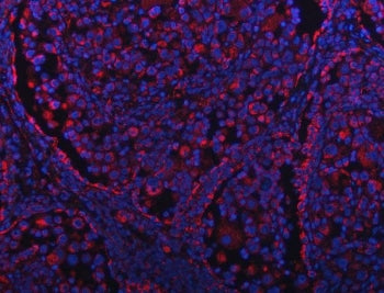 GRIM19 Antibody / NDUFA13