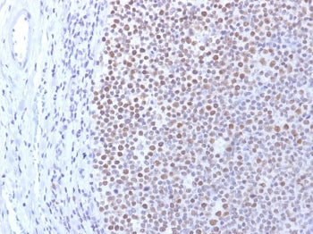 IHC staining of FFPE human tonsil with DNMT1 antibody. HIER: boil tissue sections in pH 9 10mM Tris 