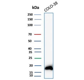 Western blot testing of human COLO-38 cell lysate with MART-1 antibody. Expected molecular weight ~2
