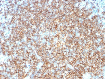 IHC testing of FFPE human tonsil tissue with CD22 antibody (clone BLCAM/1795). HIER: boil tissue sec