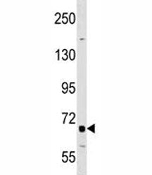 DR6 Antibody (Death Receptor 6)