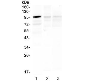 Western blot testing of 1) human Caco-2, 2) rat brain and 3) mouse brain lysate with HECTD3 antibody