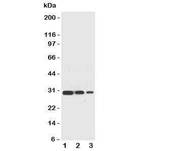 Western blot testing of TRAF2 antbody and recombinant human protein, 30.4KD with tag; Lane 1: 10ng; 