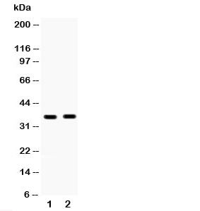 Western blot testing of HSD17B6 antibody and Lane 1: human placenta; 2: MCF-7; Predicted/observed mo