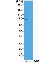 Western blot of A431 cells treated (+) or untreated (-) with EGF, using recombinant phospho-RSK1 ant