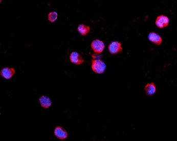 IL2RG Antibody / IL2 Receptor gamma