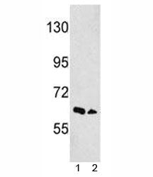 Western blot analysis of EphA3 antibody and 1) NCI-H460, 2) 293 lysate. Predicted molecular weight: 