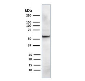 Western blot testing of mouse NIH3T3 cell lysate with AKT1 antibody. Predicted molecular weight ~56 