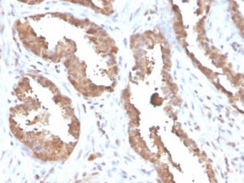 IHC staining of FFPE human prostate tissue with Glycosylation inhibiting factor antibody (clone MIF/