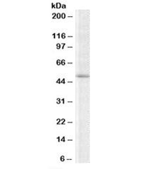 Western blot testing of K562 lysate with TRIP6 antibody at 2ug/ml. Predicted molecular weight: ~50kD