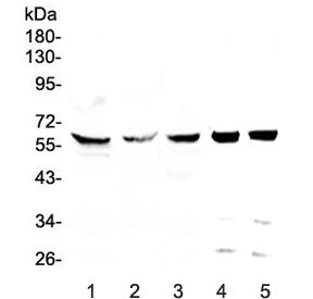 Western blot testing of human 1) HeLa, 2) HepG2, 3) MDA-MB-231, 4) rat testis and 5) mouse testis ly