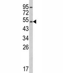 CYP2E1 Antibody