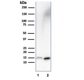 FABP1 Antibody