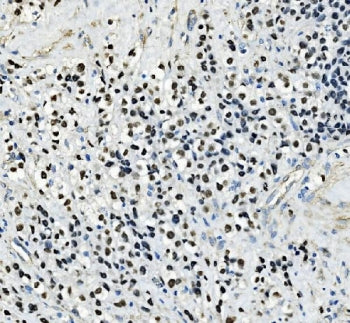 TFAP2C Antibody / AP2 gamma