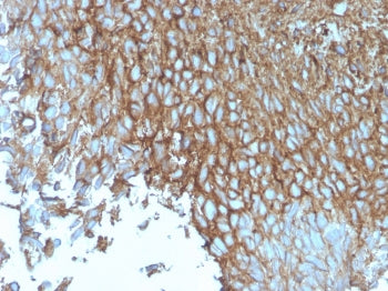 IHC staining of FFPE human bladder with recombinant GLUT1 antibody (clone rGLUT1/2476). HIER: boil t