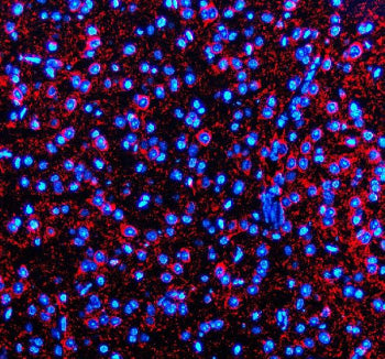 Immunofluorescent staining of Synaptotagmin-10/SYT10 using anti-SYT10 antibody (red). Synaptotagmin-