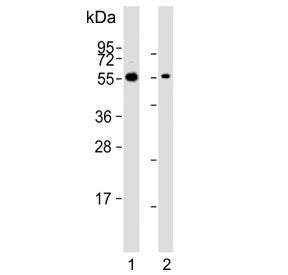 Western blot testing of human 1) 293T and 2) TT cell lysate with CDC73 antibody. Predicted molecular