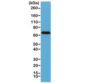 Western blot of human brain lysate using recombinant Neurofilament antibody at 1:2500. Predicted mol