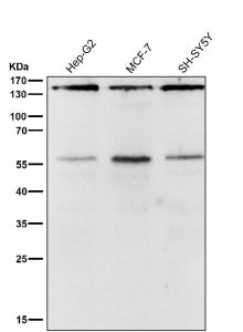 Western blot testing of human samples using the ROCK1 antibody at 1:2000 dilution for 1 hour at room