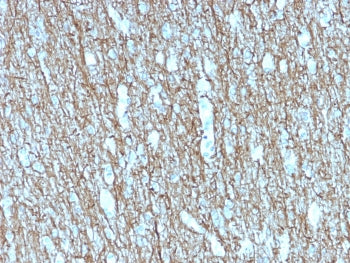 IHC testing of FFPE human brain with recombinant Neurofilament antibody (clone rNF421). Required HIE