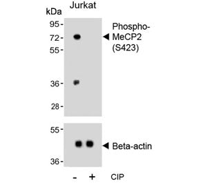 Western blot testing of lysate from human Jurkat cells treated or non-treated with CIP/CIAP (calf in