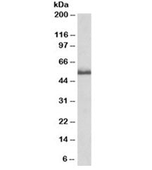 Western blot testing of rat spinal cord lysate with TNFR2 antibody at 0.2ug/ml. Predicted molecular 