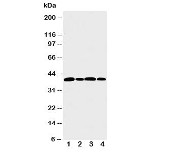 Aurora B Antibody