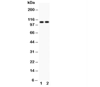 ATP2A1 Antibody