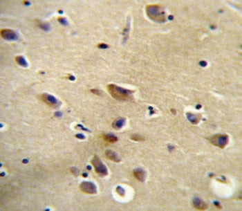 Angiotensin II Type 1 Receptor Antibody / AGTR1 / AT1R
