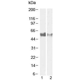 Western blot testing of human 1) lymph node and 2) tonsil tissue lysate with LAG3 antibody at 1ug/ml