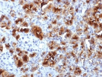 Glycoprotein 2 Antibody / GP2 / ZAP75