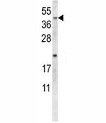 NEU1 Antibody