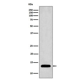 Western blot testing of human Jurkat cell lysate with Profilin 1 antibody. Predicted molecular weigh