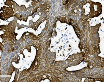 PHB Antibody / Prohibitin