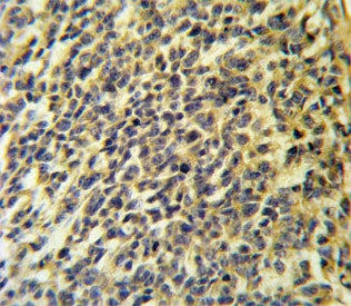 IHC testing of FFPE human testis carcinoma tissue with CaI-PLA2 antibody. HIER: steam section in pH6