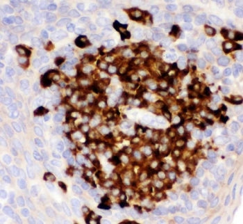 IHC staining of FFPE human tonsil tissue with CD82 antibody. HIER: boil tissue sections in pH8 EDTA 