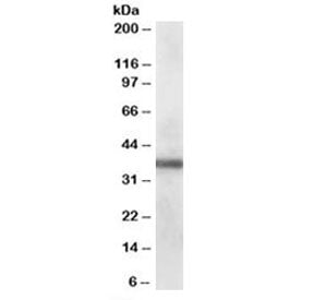 Western blot testing of human lung lysate with PDLIM1 antibody at 0.1ug/ml. Predicted molecular weig