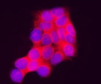 INPP4A Antibody / Inositol polyphosphate-4-phosphatase type I A