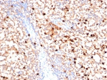 IHC staining of FFPE human bone marrow with MPO antibody (clone MPO/7116). HIER: boil tissue section