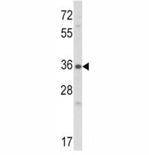 Connective Tissue Growth Factor Antibody