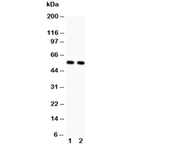 Western blot testing of GLUT4 antibody and Lane 1: rat heart; 2: rat skeletal muscle. Predicted mole
