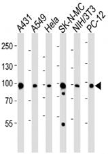 HSP90 Antibody